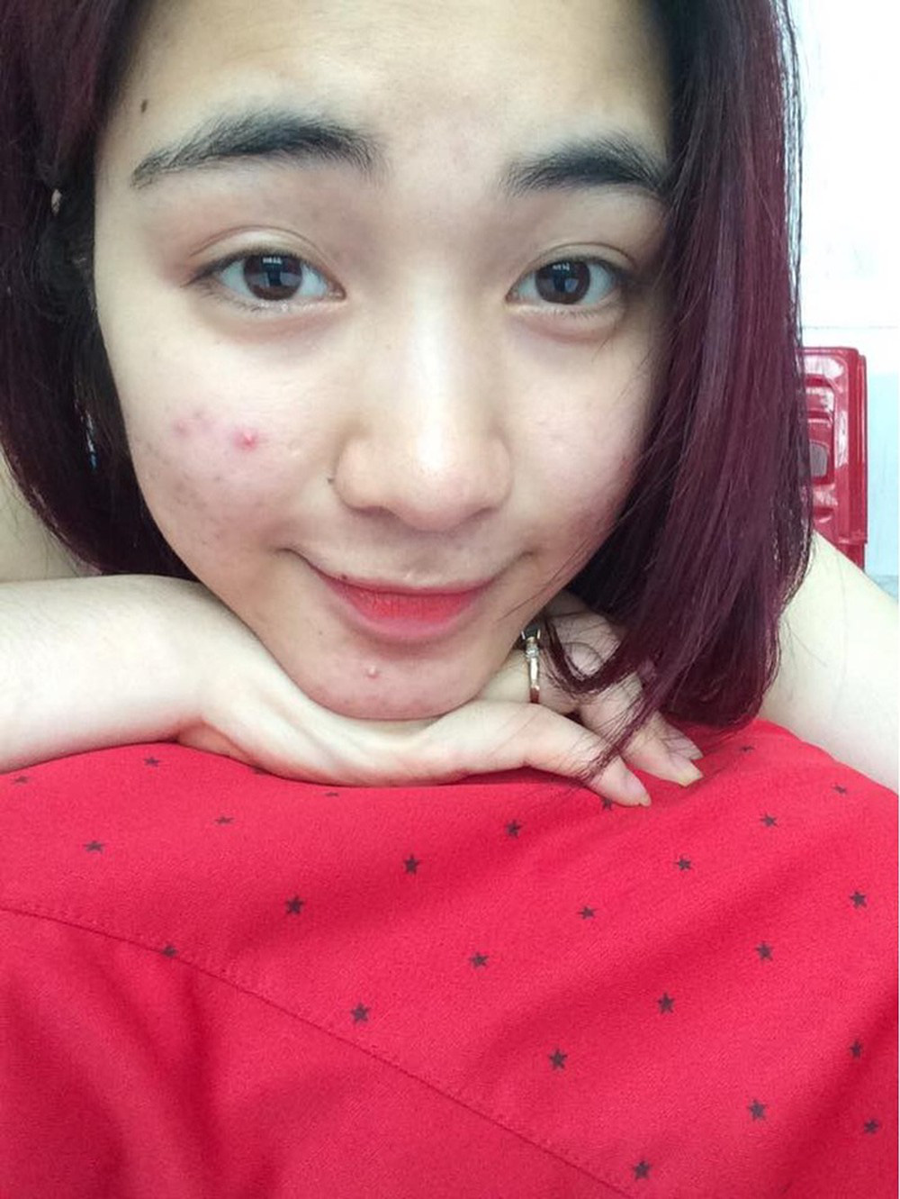 Mỹ nhân Vbiz tự bóc trần khuyết điểm: Hoà Minzy gây sốc với mặt mụn chi chít, Mai Phương Thuý như người khác với 0% make up - Ảnh 5. Mỹ nhân Vbiz tự bóc trần khuyết điểm: Hoà Minzy gây sốc với mặt mụn chi chít, Mai Phương Thuý như người khác với 0% make up - Ảnh 5.