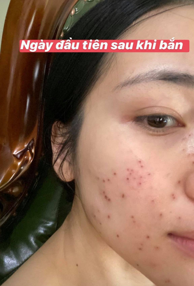 Mỹ nhân Vbiz tự bóc trần khuyết điểm: Hoà Minzy gây sốc với mặt mụn chi chít, Mai Phương Thuý như người khác với 0% make up - Ảnh 6. Mỹ nhân Vbiz tự bóc trần khuyết điểm: Hoà Minzy gây sốc với mặt mụn chi chít, Mai Phương Thuý như người khác với 0% make up - Ảnh 6.