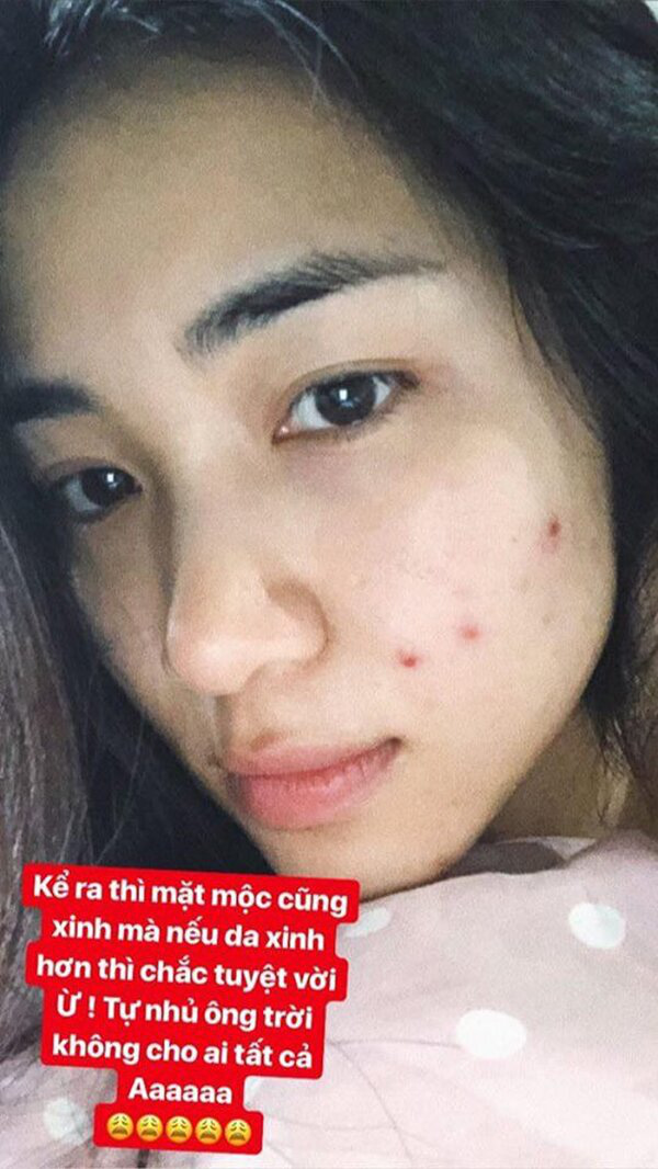 Mỹ nhân Vbiz tự bóc trần khuyết điểm: Hoà Minzy gây sốc với mặt mụn chi chít, Mai Phương Thuý như người khác với 0% make up - Ảnh 7. Mỹ nhân Vbiz tự bóc trần khuyết điểm: Hoà Minzy gây sốc với mặt mụn chi chít, Mai Phương Thuý như người khác với 0% make up - Ảnh 7.